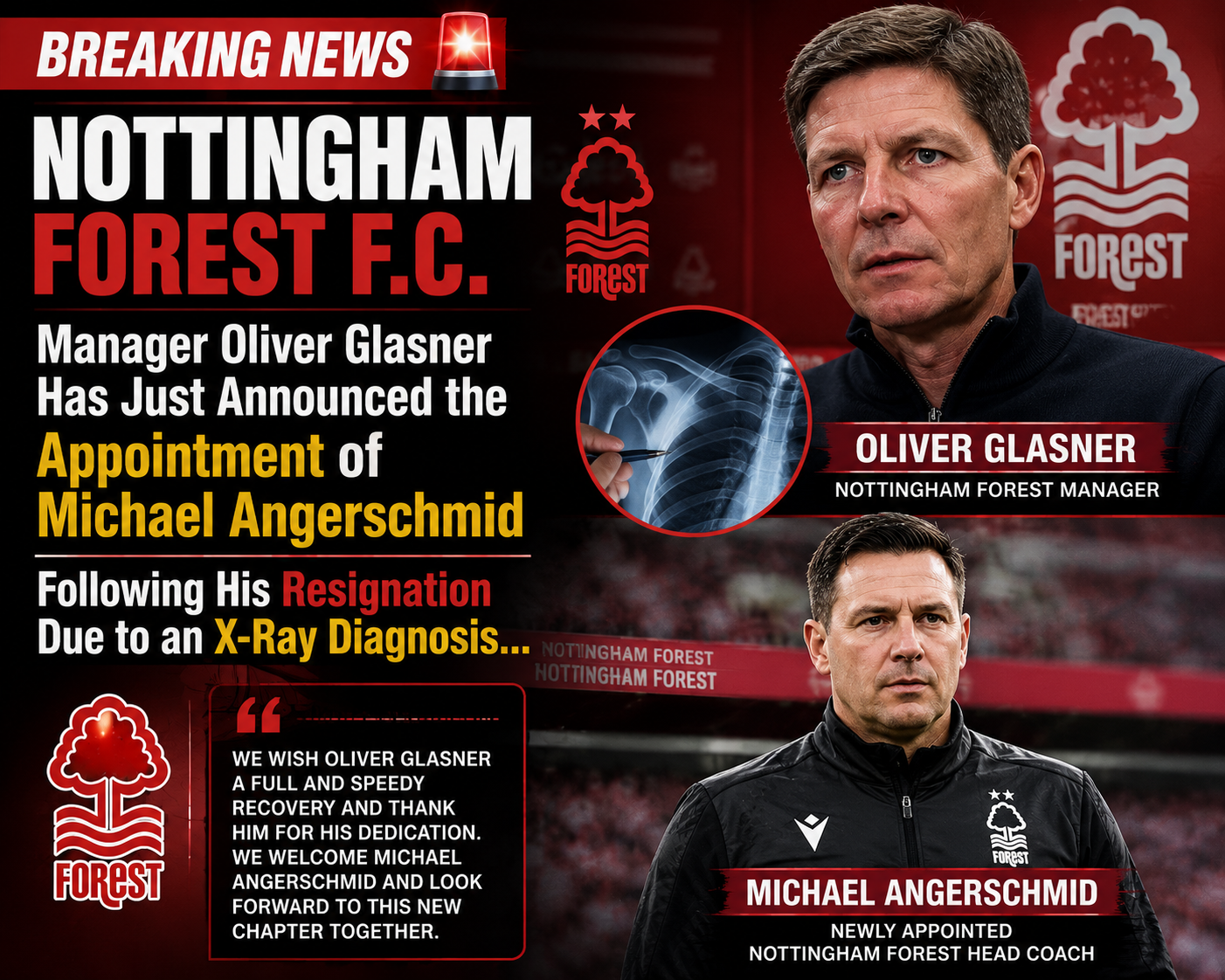 🚨 BREAKING NEWS: Nottingham Forest manager Oliver Glasner has reportedly announced the appointment of Michael Angerschmid following his resignation after an X-ray diagnosis is said to have prompted him to step away from his role.