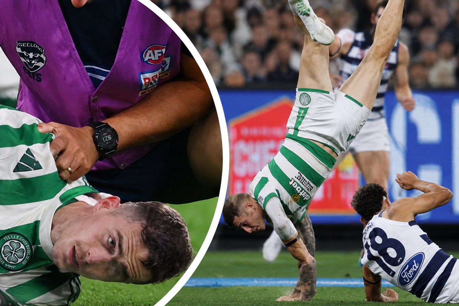 INJURY UPDATE: Celtics F.C. Defender Luke McCowan sustained a serious fracture in his left forearm in last game against… see more